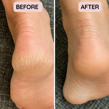 Load image into Gallery viewer, HeelSilk - No more ripped socks, scratched sheets, or sandal shame.
