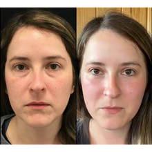 Load image into Gallery viewer, Delauna – The 5-Minute Ritual for Women Who Do Everything Right...and Still Look Puffy
