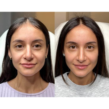 Load image into Gallery viewer, Delauna – The 5-Minute Ritual for Women Who Do Everything Right...and Still Look Puffy
